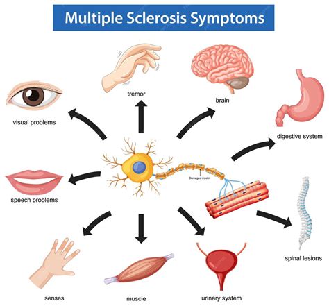 diagramma che illustra i sintomi dell'ADHD