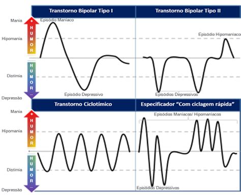 Gráfico comparando a expectativa de vida de pessoas com e sem transtorno bipolar