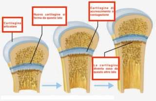 Radiografia di ossa lunghe con cartilagine di accrescimento