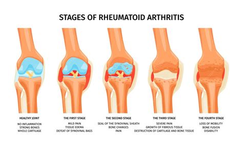 Infografica che mostra i quattro elementi che contribuiscono alla fluidità cognitiva