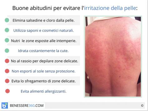 Pelle secca e arrossata con segni di irritazione