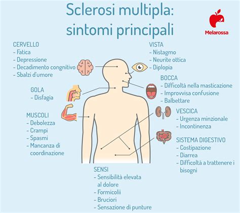 Infografica che illustra la varietà dei sintomi della sclerosi multipla