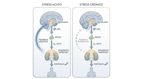 Diagramma che mostra l'effetto dello stress cronico sull'ippocampo e sulla memoria