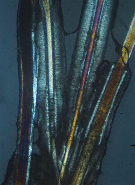 Immagine di microscopia a luce polarizzata di capelli con guaine danneggiate