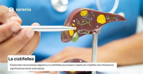 Alimenti salutari per la cistifellea