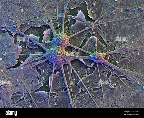 Microscopio che osserva cellule nervose