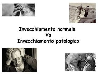 Diagramma che illustra il continuum tra invecchiamento normale, MCI e demenza