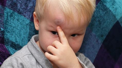 Bambino con tic alla testa