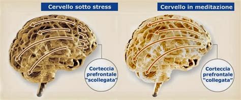 Illustrazione del cervello sotto stress