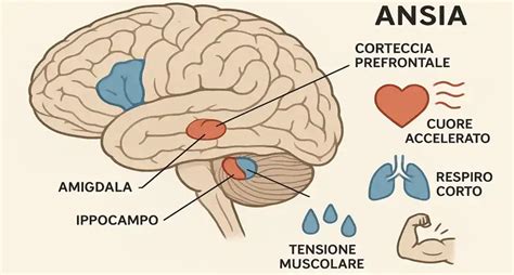 Diagramma che illustra la risposta 
