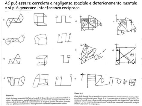 Illustrazione di un test di copia di disegni con modello e copia da parte del paziente
