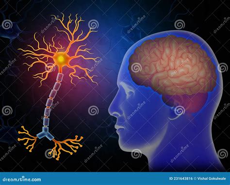 Illustrazione di un cervello con neuroni danneggiati