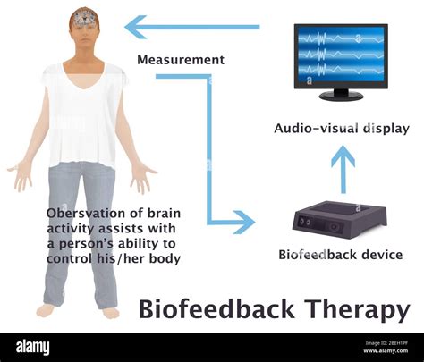 Schema del funzionamento del biofeedback