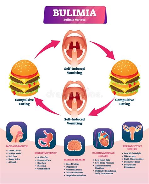 Illustrazione concettuale della bulimia nervosa con elementi visivi che rappresentano cicli di abbuffate e purghe e stati d'animo negativi.