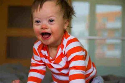 Bambino con sindrome di Down che interagisce con un genitore