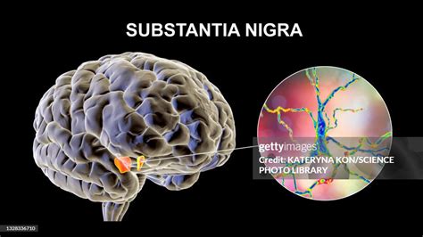 Diagramma del cervello con evidenziata la substantia nigra