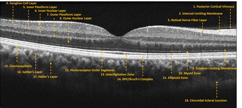 Immagine OCT della retina