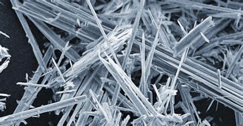 Fibre di amianto al microscopio