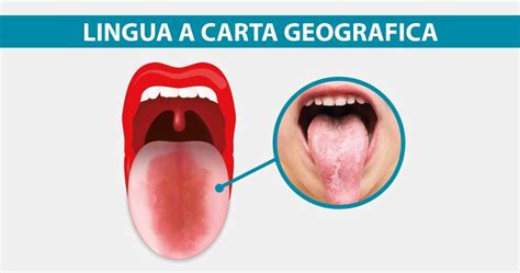 Illustrazione della lingua a carta geografica
