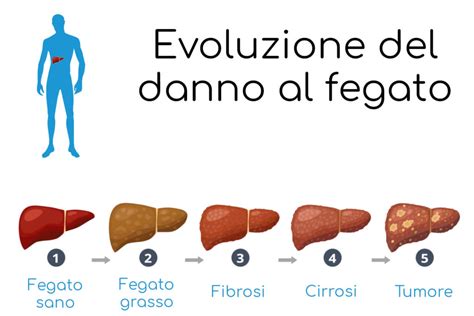 Illustrazione delle diverse cause di dolore al fegato