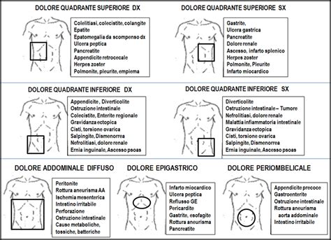 Diagramma che illustra le cause comuni di dolore addominale destro