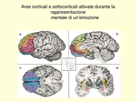 Diagramma comparativo della connettività cerebrale in autismo e controllo