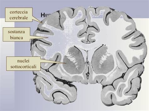 Cervello umano con evidenziata la sostanza bianca