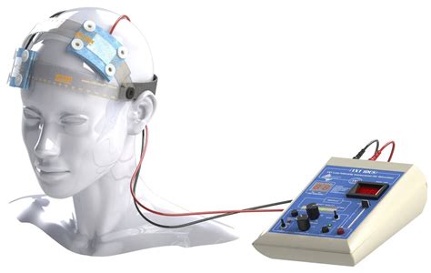 Immagine che illustra l'applicazione della tDCS sul capo di un paziente