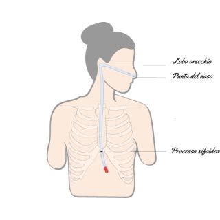 Illustrazione anatomica del percorso del sondino nasogastrico dallo stomaco.