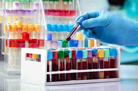 Laboratorio di analisi cliniche con provette e strumenti