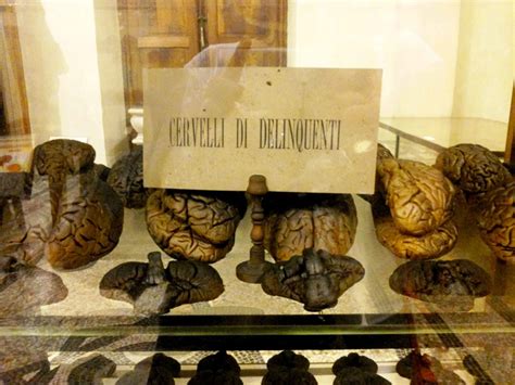 Collezione di cervelli umani conservati