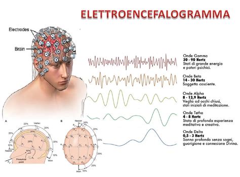 Schema di un elettroencefalogramma (EEG)