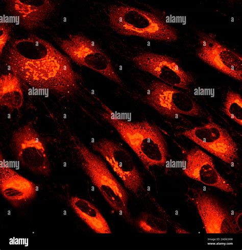Micrografia di cellule di fibroblasti